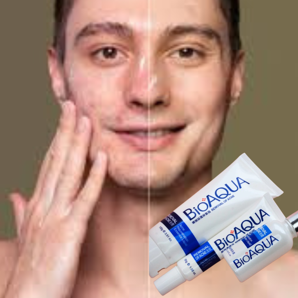 Set Facial Anti-acné Bioaqua