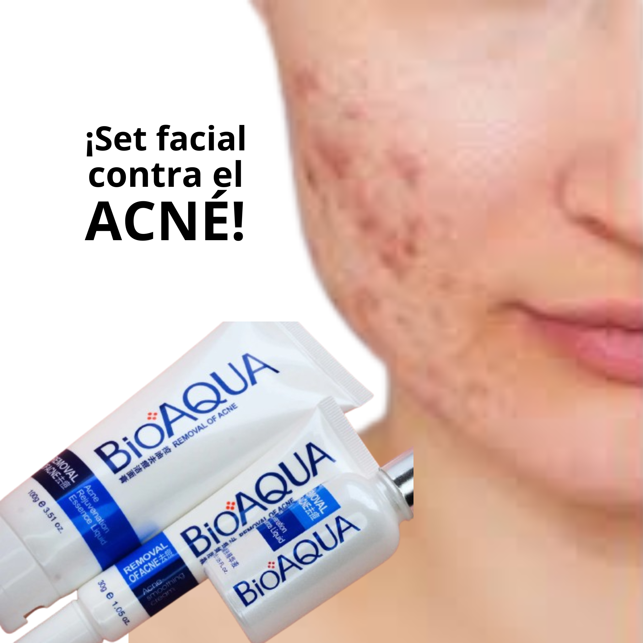 Set Facial Anti-acné Bioaqua